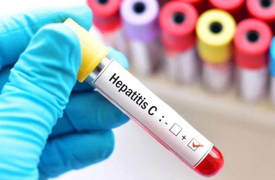 El testeo es la única forma de saber si alguien tiene hepatitis C.
